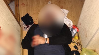 На Сумщині напали на одного з кандидатів у депутати, нападника затримали