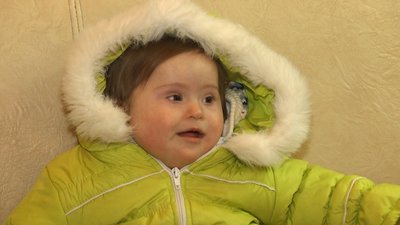 Рання реабілітація дітей з інвалідністю на Житомирщині Рання реабілітація дітей з інвалідністю на Житомирщині