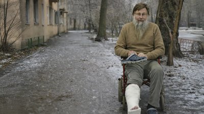 Житель Одеси з переломом ноги