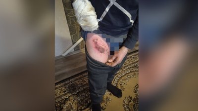 На Черкащині парубки підпалили сплячого чоловіка заради відео у "TikTok" На Черкащині парубки підпалили сплячого чоловіка заради відео у "TikTok"