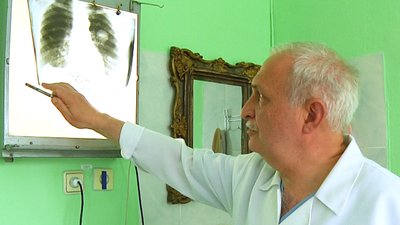 Житомирські лікарі розповіли, що половина хворих на рак легень звертаються по допомогу запізно