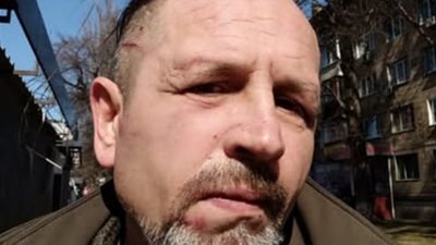 Володимир Балух — поліція перевіряє побиття експолітв'язня у Шевченківському ТЦК Києва