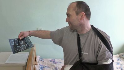 "Вже можу називати себе військовим з досвідом", – історія бійця, який лікується після поранення на Волині "Вже можу називати себе військовим з досвідом", – історія бійця, який лікується після поранення на Волині