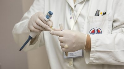 Миколаївська область отримає 23 тисячі експрес-тестів на COVID-19