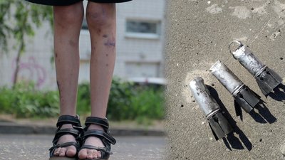 Вижили під час обстрілу касетними снарядами: історії вцілілих чернігівців