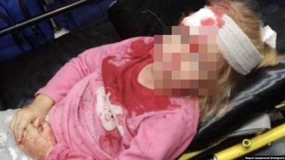 У Білорусі в аварії з військовим авто постраждала п'ятирічна дівчинка