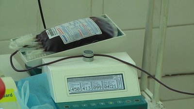 Житомирський обласний центр крові заготовив 13 доз плазми з антитілами до COVID-19