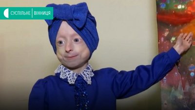 9-річну вінничанку із синдромом передчасного старіння почнуть лікувати — МОЗ