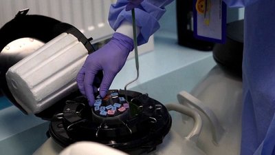 Безплатна послуга з кріоконсервації сперми: куди звертатись жителям Кіровоградщини