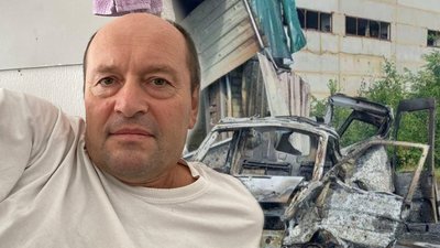Прошиті кістки та відірвані пальці: як головний енергетик ХТЗ лікується після обстрілу Харкова