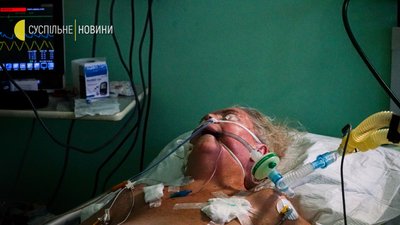 ФОТОРЕПОРТАЖ РЕАНИМАЦИЯ