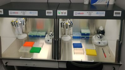 Житомирщина отримала мобільну лабораторію від США та ВООЗ, яка робитиме тести на коронавірус