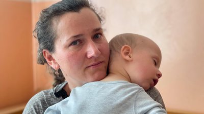 Львівські хірурги прооперували однорічного хлопчика за допомогою робота Da Vinci Львівські хірурги прооперували однорічного хлопчика за допомогою робота Da Vinci