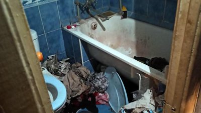 У Запоріжжі через неналежний догляд померла чотиримісячна дитина У Запоріжжі через неналежний догляд померла чотиримісячна дитина