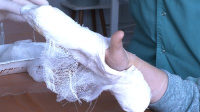 Харків'янка, дитину якої травмували шкільні двері, звинувачує заклад у халатності