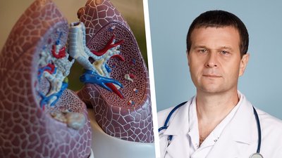 Фактори виникнення, групи ризику, виявлення та лікування. Кропивницький онкохірург – про рак легенів