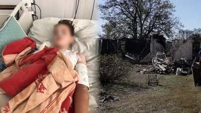У якому стані хлопчик, який зазнав опіків через атаку РФ по селу Володькова Дівиця