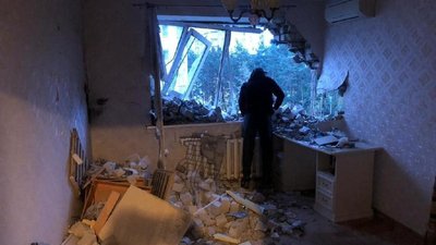 Життю нічого не загрожує: лікар про стан дитини з Українки, постраждалої через ракетну атаку