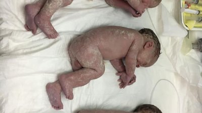 У Кропивницькому народилася трійня У Кропивницькому народилася трійня