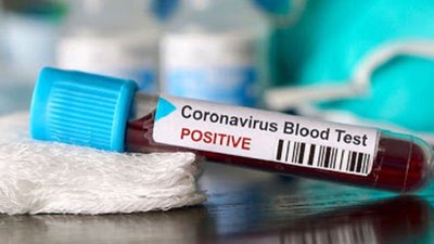 COVID-19: на Херсонщині за добу захворіло 197 людей, з них 26 - медичні працівники