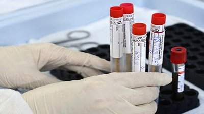 На Херсонщині за добу 107 нових випадків захворювання на COVID-19