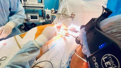 Львівські хірурги прооперували серце через 5-сантиметровий розріз