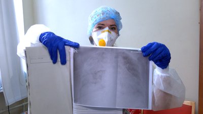 За три дні – тотальне ураження: як виглядають рентгенівські знімки легенів пацієнтів з COVID-19 За три дні – тотальне ураження: як виглядають рентгенівські знімки легенів пацієнтів з COVID-19