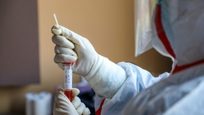 На Чернігівщині 449 людей захворіли на коронавірус, семеро померли