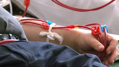 11 років на діалізі або раптовий дзвінок серед ночі. Як на Франківщині проводять трансплантації 11 років на діалізі або раптовий дзвінок серед ночі. Як на Франківщині проводять трансплантації