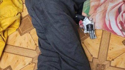 Вистрелив з пістолета собі у голову: в Одесі лікарі швидкої врятували чоловіка від самогубства