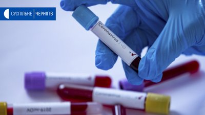 На Чернігівщині ще в однієї людини виявили коронавірус