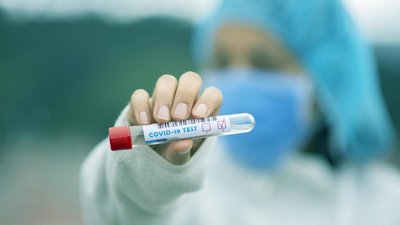 Коронавірус виявили у 160 жителів Чернігівщини