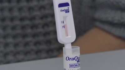 Перевіритись на ВІЛ вдома: чернігівці можуть визначити свій ВІЛ-статус за допомогою слинних тестів