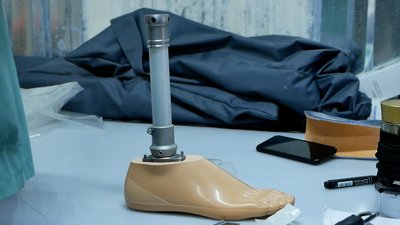 "Військовим — на рівень вища мобільність комплектації". Як у Чернівцях безплатно виготовляють протези "Військовим — на рівень вища мобільність комплектації". Як у Чернівцях безплатно виготовляють протези