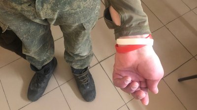 У Росії "вагнерівці" вербують в’язнів, хворих на ВІЛ і гепатит