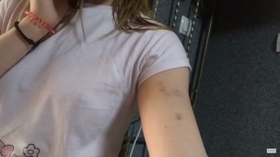 У поліції розслідують можливе побиття поліцейською дівчини у Міжгір`ї