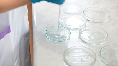 Лабораторі, проби води, холера на Херсонщині