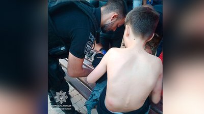 У Житомирі 12-річного хлопчика покусали вуличні пси У Житомирі 12-річного хлопчика покусали вуличні пси