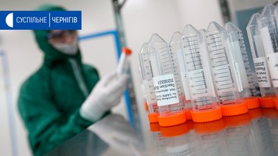 За останню добу на Чернігівщині у 13 людей виявили COVID-19