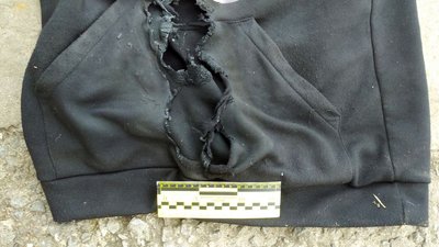 На Рівненщині в руках чоловіка вибухнула навчальна граната На Рівненщині в руках чоловіка вибухнула навчальна граната