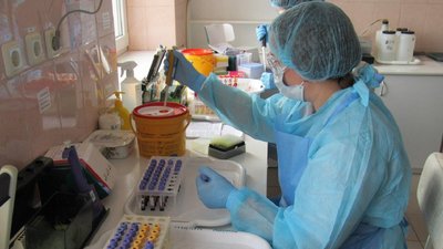 COVID-19 виявили у 1 484 мешканців Одещини