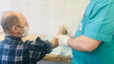 Пальці працюють: у луцькій лікарні показали результат реплантації руки Пальці працюють: у луцькій лікарні показали результат реплантації руки