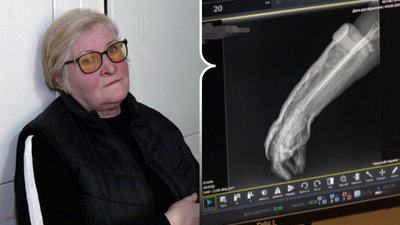 Травми через ожеледицю в Луцьку, травмпункт Луцьк