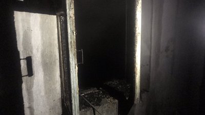 У Житомирі на пожежі чоловік отримав опіки