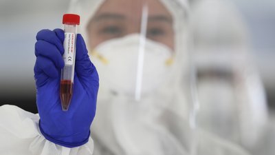 В Україні виявили майже 500 нових випадків COVID-19