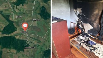 На Рівненщині чоловік заявив, що його облили бензином і підпалили. Він у важкому стані