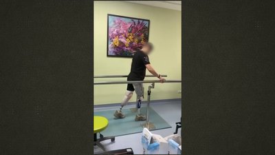 Протези для військових: як їх виготовляють на Рівненщині Протези для військових: як їх виготовляють на Рівненщині