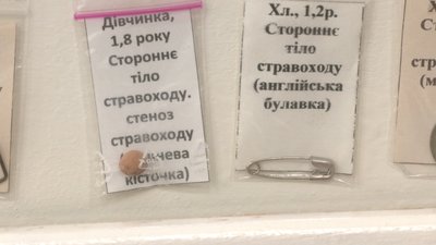 "Хочуть спробувати на зуб": лікар-ендоскопіст з Рівного показав, що найчастіше ковтають діти "Хочуть спробувати на зуб": лікар-ендоскопіст з Рівного показав, що найчастіше ковтають діти