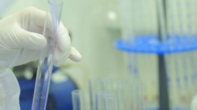 За добу на Сумщині COVID-19 підтвердили у 748 людей, двоє - померли