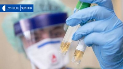 На Чернігівщині дві нові підозри на коронавірус